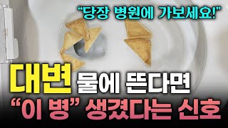 이런 대변 대장암의 신호일 수 있습니다 대변 모양으로 내 건강 상태 확인하는 법 변기에 뜨는 변 혈변 변비 묽은 변 토끼 똥 [upl. by Aimal]