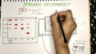 HEMOGLOBIN ELECTROPHORESIS [upl. by Olivero]