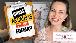 Edema Quais as suas Causas  Gabi Tuller [upl. by Jethro263]