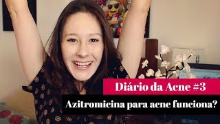 Antibiótico Azitromicina para ACNE  por Letícia Menezes [upl. by Oiled432]