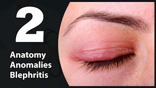 2 Eye lids Anatomy Congenital anomalies amp Blephritis [upl. by Nycila]