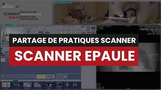 CT SCANNER EPAULE  Partage de pratique [upl. by Kcuhc]