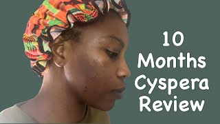 Cyspera Before And After 10 Months Review Answering Questions [upl. by Ivo]