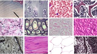 Practice Identifying Connective Tissue Complete [upl. by Koorb]