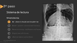 Radiografía de Abdomen Paso a Paso [upl. by Leibman]