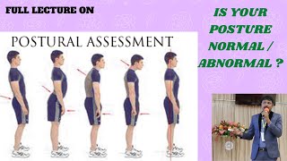 POSTURAL ASSESSMENT Lordosis Sway back deformity Kyphosis  Round back humpback  Scoliosis [upl. by Harland]