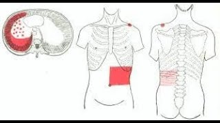 Why Pleurisy pain  Pleuritis pain is referred to the anterior abdominal wall [upl. by Fredi]