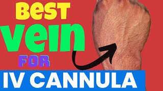 How To Find the Best Vein To Fix A Intravenous Cannula in First Prick  iv Cannulation mede easy [upl. by Yriek]