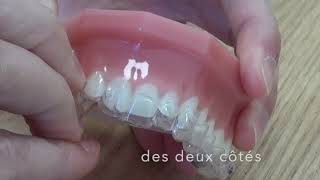 Comment mettre et retirer ses aligners Invisalign [upl. by Sellma]