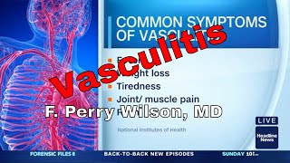 What is Vasculitis [upl. by Enella763]