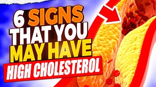 High Cholesterol Alert 6 Symptoms You Shouldnt Ignore [upl. by Lyrad]