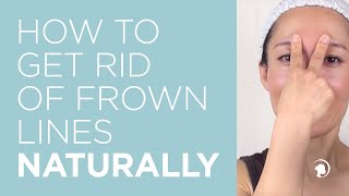 How to Get Rid of Frown Lines Naturally [upl. by Anayia]