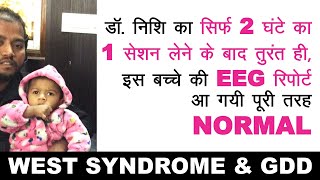 West Syndrome Treatment  सिर्फ 2 घंटे का 1 सेशन लेने के बाद तुरंत ही EEG Report आ गयी पूरी NORMAL [upl. by Ennairek]