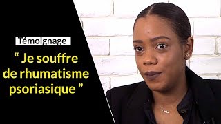 Rhumatisme psoriasique  le quotidien d’Azania jeune maman [upl. by Spohr]