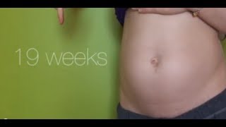 19 Weeks Pregnant  Food Troubles 7lbs Anatomy Scan BAD SKIN [upl. by Giraldo]