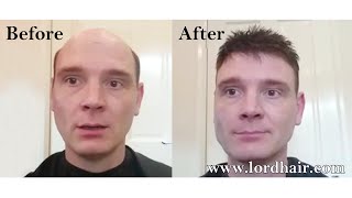 Toupee before and after – Lordhair changes Stephens Life [upl. by Haram]