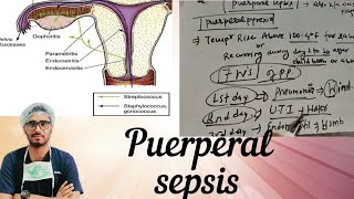 Puerperal sepsis part 1 [upl. by Scrogan44]