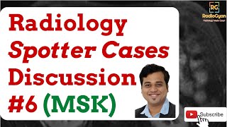 MSK Radiology Cases  Spotters Set 6  Quiz and Discussion LIVE [upl. by Eicrad543]