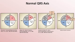 Intro to EKG Interpretation  Rate and Axis [upl. by Ellenaj]