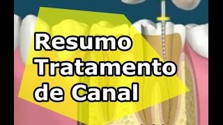 Tratamento de Canal  Como Funciona PassoaPasso RESUMO [upl. by Celina]