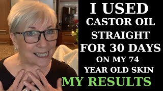 I USED CASTOR OIL FOR 30 DAYS ON MY 74YEAROLD SKIN  MY RESULTS [upl. by Gershon]