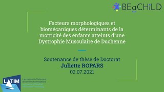 Facteurs déterminants de la motricité des enfants atteints dune Dystrophie Musculaire de Duchenne [upl. by Itoc]