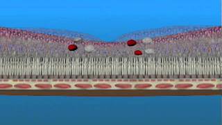 Macular Edema and Ischemia [upl. by Odlabu208]