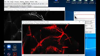 Using ImageJ FIJI to visualize confocal microscopy image stack video tutorial [upl. by Jolie586]