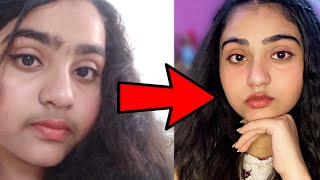 Teenage Facial Hair Removal with total Natural Ingredients How I removed my Facial Hairs Naturally [upl. by Nairrad]