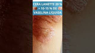 Excipiente emulsiones para psoriasis [upl. by Aelanej]