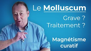 Le Molluscum Expliqué et Comment sen Débarrasser [upl. by Ysac276]