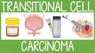 Transitional Cell Carcinoma [upl. by Moritz]