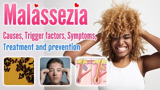 Malassezia causes conditions symptoms trigger factor treatment and prevention [upl. by Llenrac]