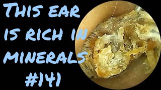 This ear is rich in minerals​​ 141 [upl. by Ewan928]