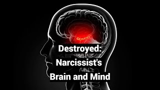 Destroyed Narcissists Brain and Mind Infant Amnesia Psychotic Grandiosity [upl. by Adalia]