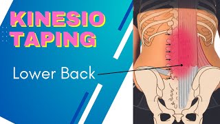 Lumbar spine or Sacroiliac Joint pain  try Kinesiology Taping technique using Rocktape Big Daddy [upl. by Marler]