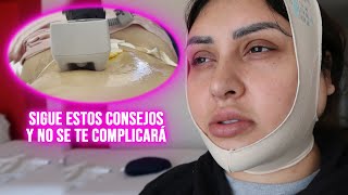 CÓMO SON LOS PRIMEROS 15 DIAS DESPUÉS DE UNA ABDOMINOPLASTIA Y LIPOESCULTURA TODOS LOS TIPS AQUÍ [upl. by Tegdig]