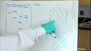 Electrophoresis How to Read Results [upl. by Geffner]