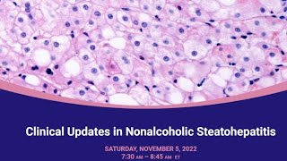 Clinical Updates in Nonalcoholic Steatohepatitis [upl. by Bascio]