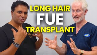 Long Hair FUE for Hair Transplant Surgery [upl. by Crispen58]