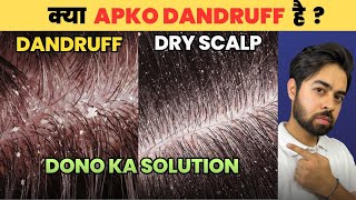 Say Goodbye to Dandruff or Dry Scalp HONEST SOLUTIONS [upl. by Miculek]