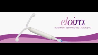 Eloira Loading amp Insertion Mechanism  Hormonal IUD [upl. by Gilges]