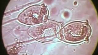 Klärwerk Biologische Reinigung [upl. by Aciria]