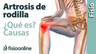 ¿Cómo tratar un esguince del ligamento lateral externo de rodilla  Fisioterapia Bilbao [upl. by Iren948]