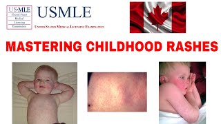 MASTERING CHILDHOOD RASHES MEASLES RUBELLA ROSEOLA SCARLET FEVER USMLE MCC CLINICAL MEDICINE [upl. by Sonni]