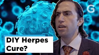 Biohacker Injects Himself With An Untested DIY Herpes Cure [upl. by Bobbe]