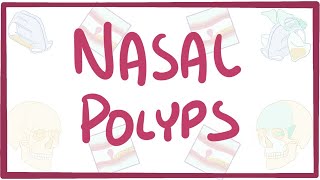 Nasal Polyps  causes symptoms diagnosis treatment pathology [upl. by Aivin]