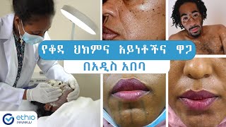 የቆዳ ህክምና አገልግሎት አይነቶችና ዋጋ በአዲስ አበባ 2015 Dermatology Price in Addis Ababa Ethiopia  Ethio Review [upl. by Sirah489]