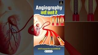 What is Angiography in Hindi angiography radiographerexam testpaperliveparamedicalclasses [upl. by Champagne487]