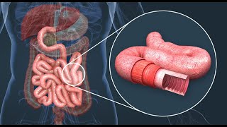 Comprendre L absorption intestinale  SVT [upl. by Krein959]